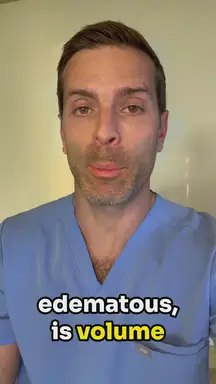 'Video thumbnail for Fluid Overload but Intravascularly Depleted (One-Minute Journal Club)'