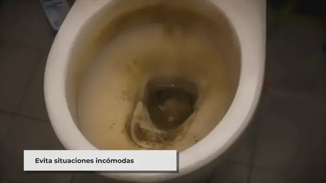 Video thumbnail for ▷ ¿Cómo elimino las manchas fecales de los inodoros? (7 maneras fáciles)