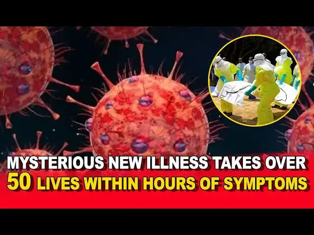 Video thumbnail for Mysterious New Illness Takes Over 50 Lives Within Hours of Symptoms 😱 | What You Need to Know