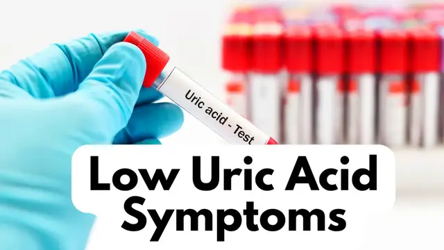 Video thumbnail for Low Uric Acid Symptoms- video