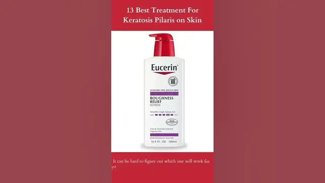 Video thumbnail for 13 Best Treatment For Keratosis Pilaris on Skin | Eucerin Roughness Relief Body Lotion