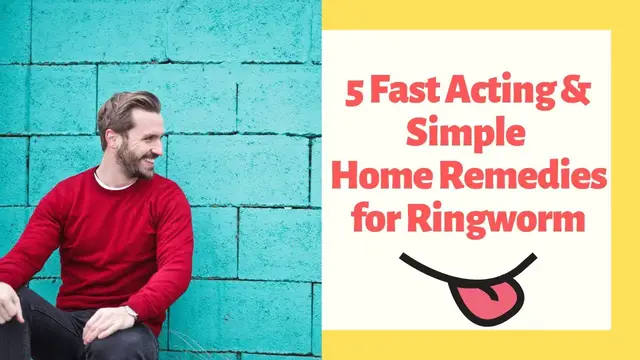 'Video thumbnail for 5 Fast Acting & Simple Home Remedies for Ringworm'