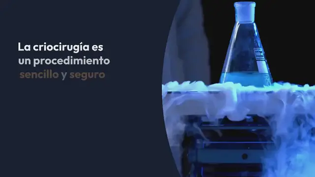 Video thumbnail for Criocirugía o crioterapia: ¿qué es y para qué sirve?