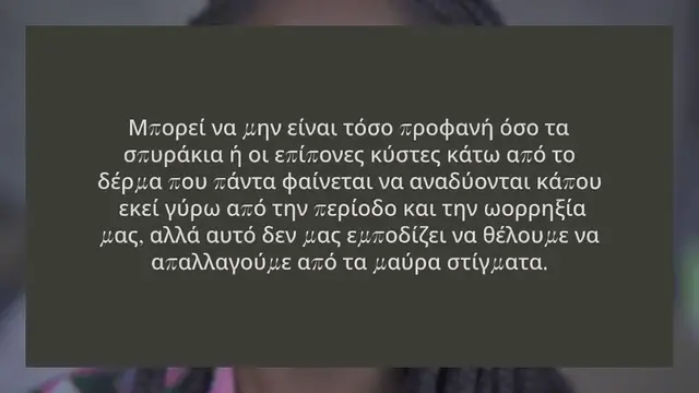 Video thumbnail for ΟΙ 3 ΚΑΛΥΤΕΡΕΣ ΜΑΣΚΕΣ ΕΝΑΝΤΙΑ ΣΤΑ ΜΑΥΡΑ ΣΤΙΓΜΑΤΑ