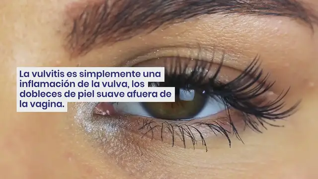 Video thumbnail for Vulvitis: síntomas y recomendaciones