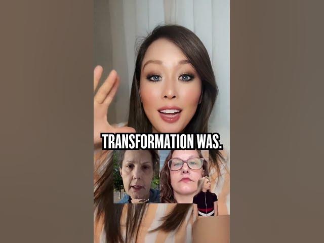 Video thumbnail for Her facelift made her go from 50 to 17