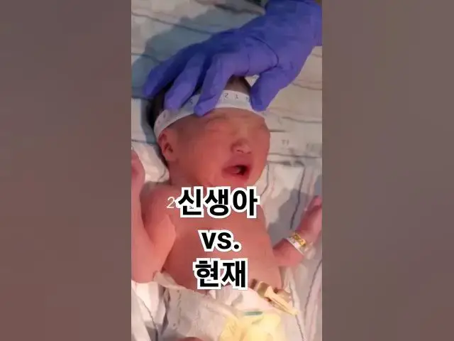 Video thumbnail for 신생아 얼굴 걱정 안해도 되는 이유