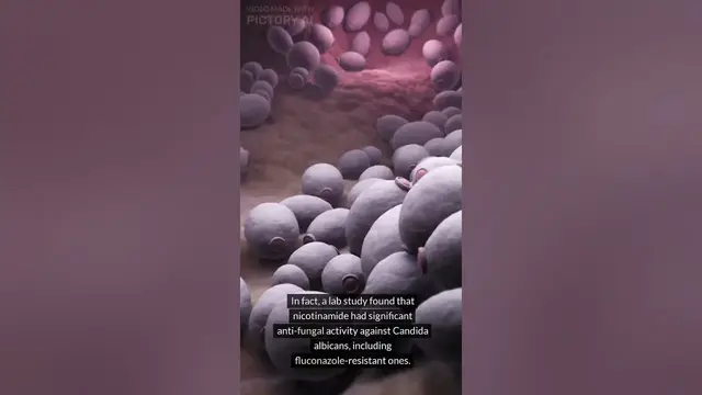 'Video thumbnail for Does Niacinamide Kill Malassezia? #shorts #sebderm #seborrheicdermatitis #niacinamide'