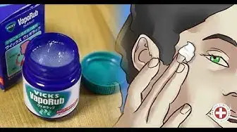 'Video thumbnail for I Never Would Have Imagined That VapoRub Could Be Used Like This'