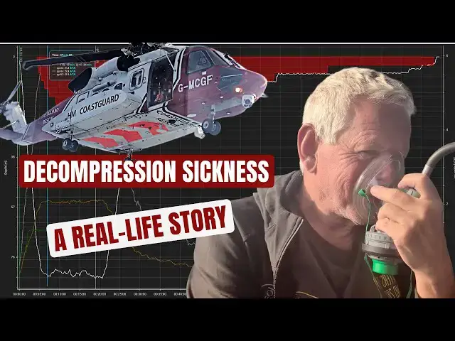 'Video thumbnail for What REALLY Happens When You Get Decompression Sickness'