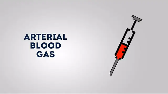 Video thumbnail for Arterial blood gas sampling