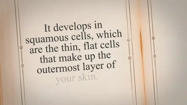 Video thumbnail for All you should know about Squamous Cell Cancer | Ewacoltd