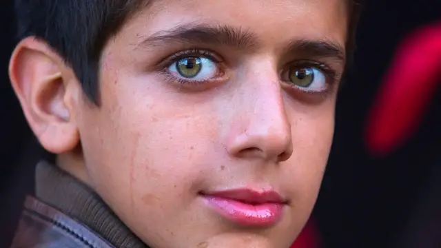 Video thumbnail for Green Eyes Can Have One Big Side Effect