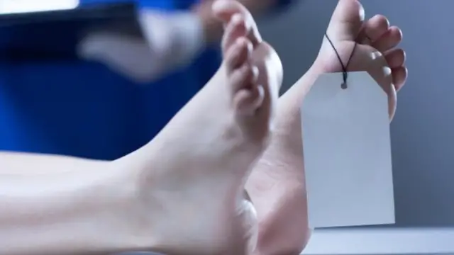 'Video thumbnail for What Happens To Your Body When You Donate It To Science'