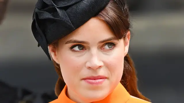 Video thumbnail for The Serious Health Condition Princess Eugenie Sadly Lives With