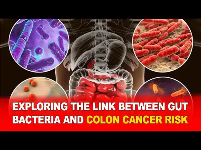 Video thumbnail for Exploring the Link Between Gut Bacteria and Colon Cancer Risk 🧬🦠 | What You Need to Know