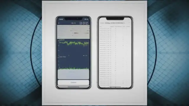 Video thumbnail for Interpreting Overnight Oximetry Readings