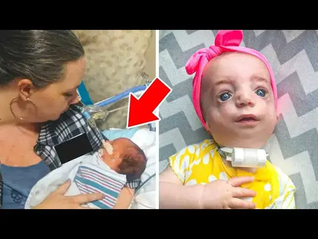 Video thumbnail for Baby with Down Syndrome Abandoned at Birth Becomes an Actress Years Later