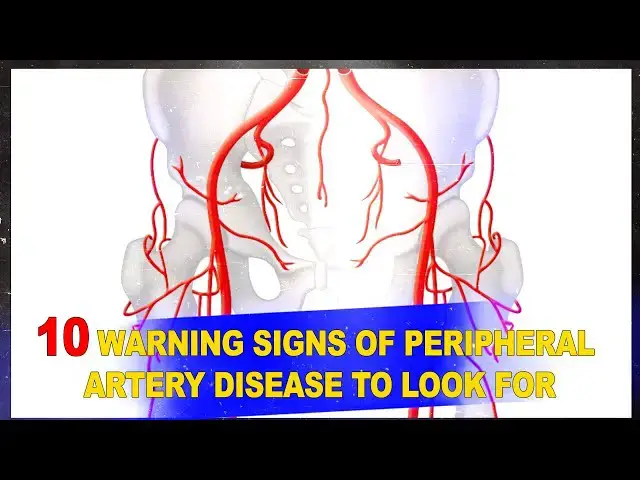 Video thumbnail for 10 Warning Signs of Peripheral Artery Disease (PAD) 🚨 | Don’t Ignore These Symptoms!
