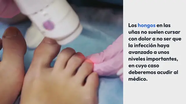 Video thumbnail for Cómo combatir los hongos en las uñas