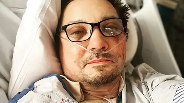 Video thumbnail for Celebrities Who Were Critically Injured In Accidents