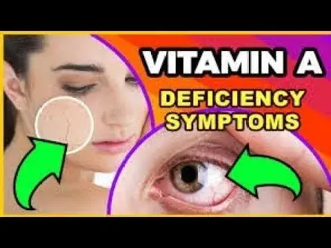 'Video thumbnail for 9 Sneaky Symptoms That Can Be A Sign of a Vitamin A Deficiency'