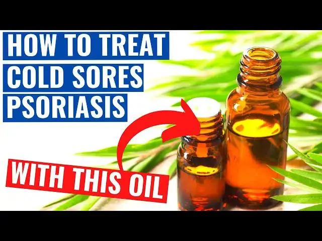 Video thumbnail for How to Treat Cold Sores, Psoriasis and Chickenpox With This Oil