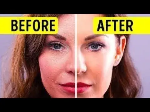 'Video thumbnail for Get Rid Of Wrinkles & Slim Your Face With These 7 Facial Exercises'