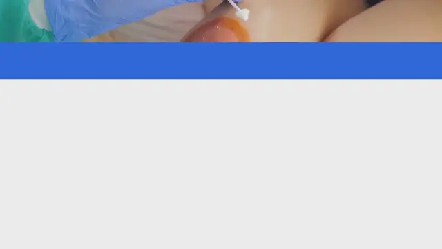 Video thumbnail for Pasos para curar una herida infectada de forma higiénica