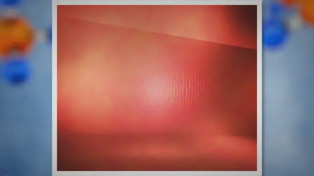 Video thumbnail for Importance de la microbiologie en médecine