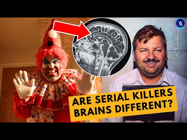 Video thumbnail for Serial Killers Brains Reveal Extraordinary Discovery