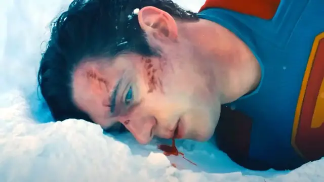 Video thumbnail for The Real Reason Superman Bleeds According To James Gunn