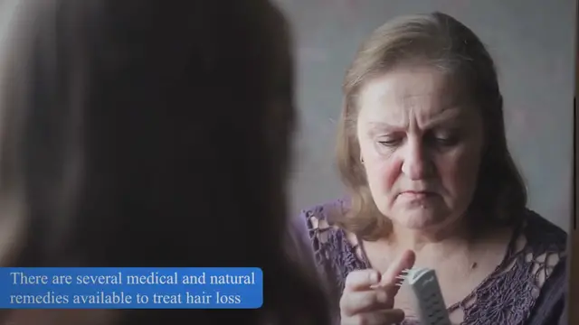 'Video thumbnail for The Ultimate Guide to Preventing and Curing Hair Loss: Understanding the Causes, Prevention Strategies, Treatment Options, and Tips for Healthy Hair Growth'