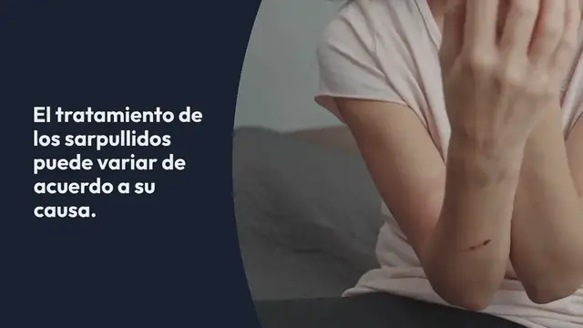 Video thumbnail for Cómo tratar los sarpullidos en la piel