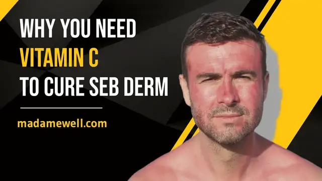 'Video thumbnail for Why You Need Vitamin C To Cure Seb Derm'