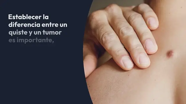 Video thumbnail for ¿Cuál es la diferencia entre un quiste y un tumor?