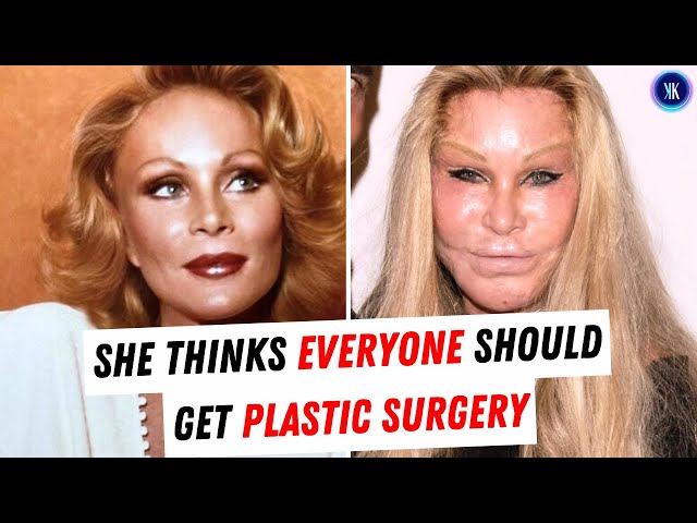 Video thumbnail for Jocelyn "Catwoman" Wildenstein: Plastic Surgery's Biggest Fan