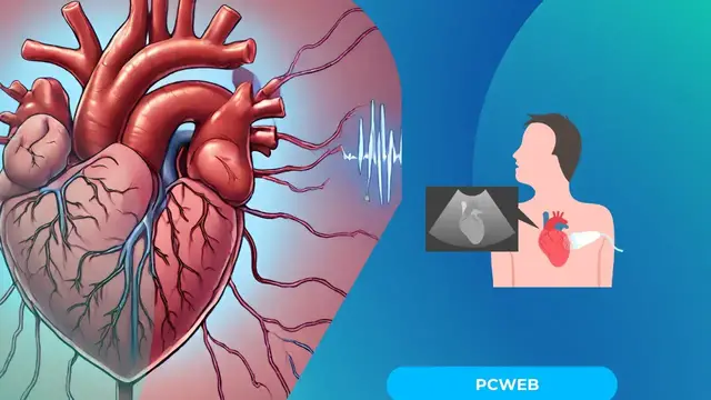 Video thumbnail for Fibrilacion auricular ¿que es? Video blog