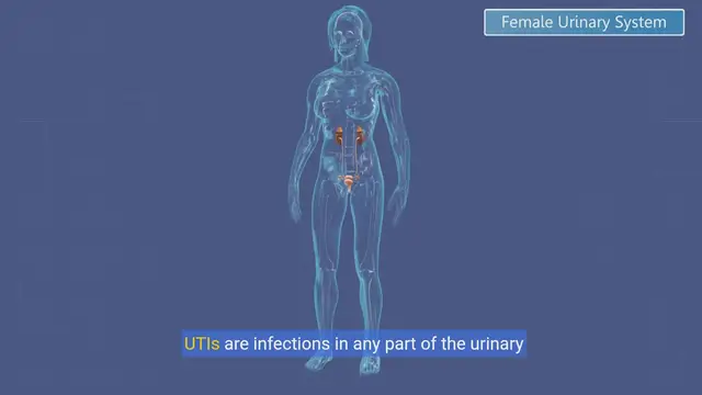 Video thumbnail for Understanding UTIs Symptoms, Prevention, and Treatment