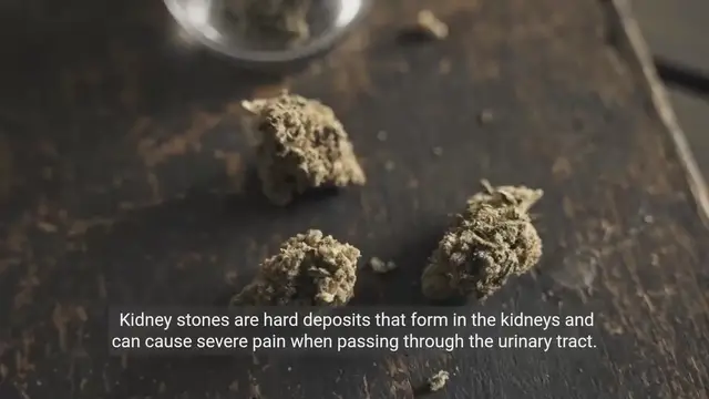 Video thumbnail for Understanding Kidney Stones and Urinary Tract Infections