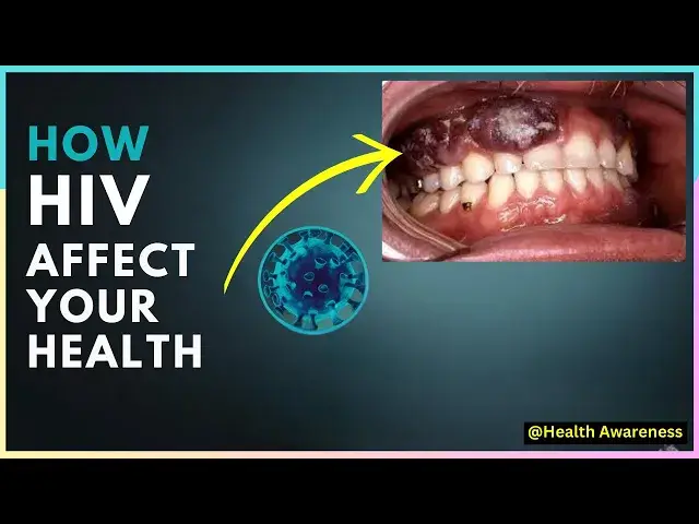 'Video thumbnail for How Does HIV Affect Your Health? Key Challenges and What You Need to Know'