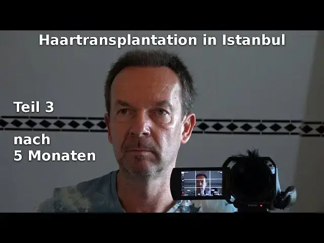Video thumbnail for Haartransplantation in Istanbul (3) nach 5 Monaten