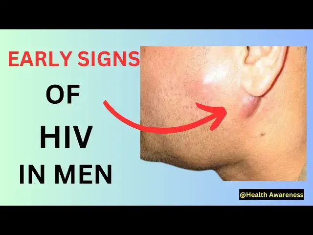 'Video thumbnail for Early Warning Signs Of HIV In Men #healthawareness'