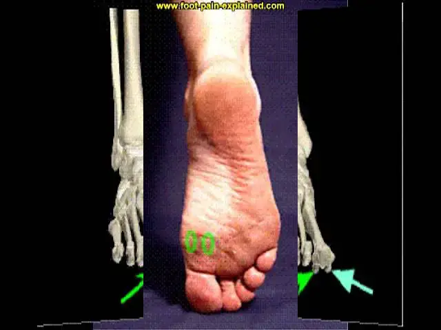 Video thumbnail for sesamoid