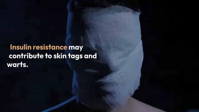 Video thumbnail for Natural_Remedy_for_Skin_Tags