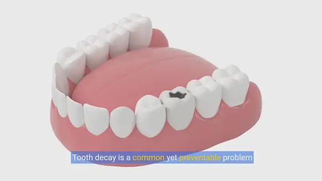 Video thumbnail for Bright Smiles: Mastering Dental Hygiene & Decay Prevention