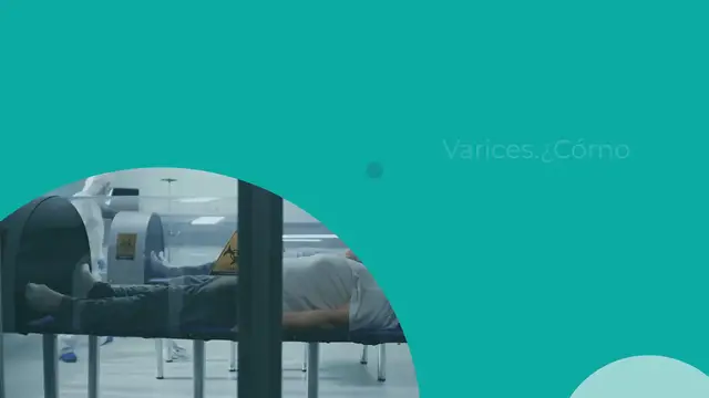 Video thumbnail for Varices. ¿Cómo mejorar su estado y evitar que aparezcan?