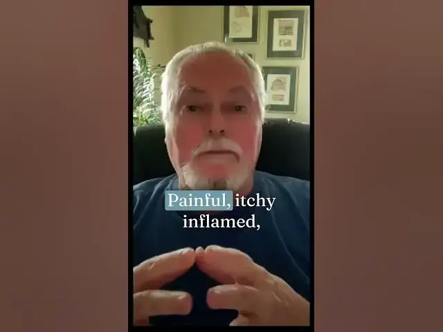 Video thumbnail for 🎙️ Hope After Melanoma: Real Stats, Real Story