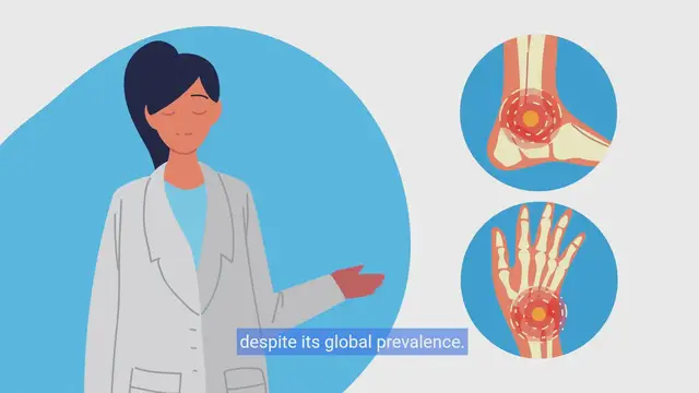 Video thumbnail for Unraveling Arthritis Causes and Prevention Explained