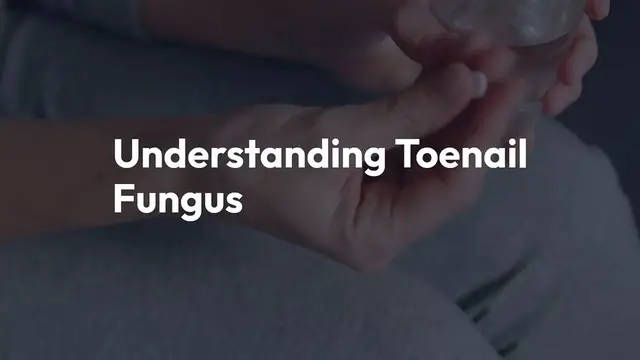 Video thumbnail for Understanding_Toenail_Fungus_Causes